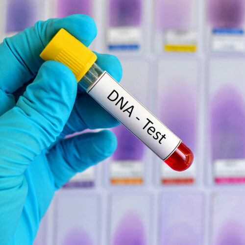 DNA Testing &#8211; Definition, Types, and Procedure