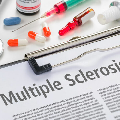 Multiple Sclerosis &#8211; Types, Diagnosis and Management Options