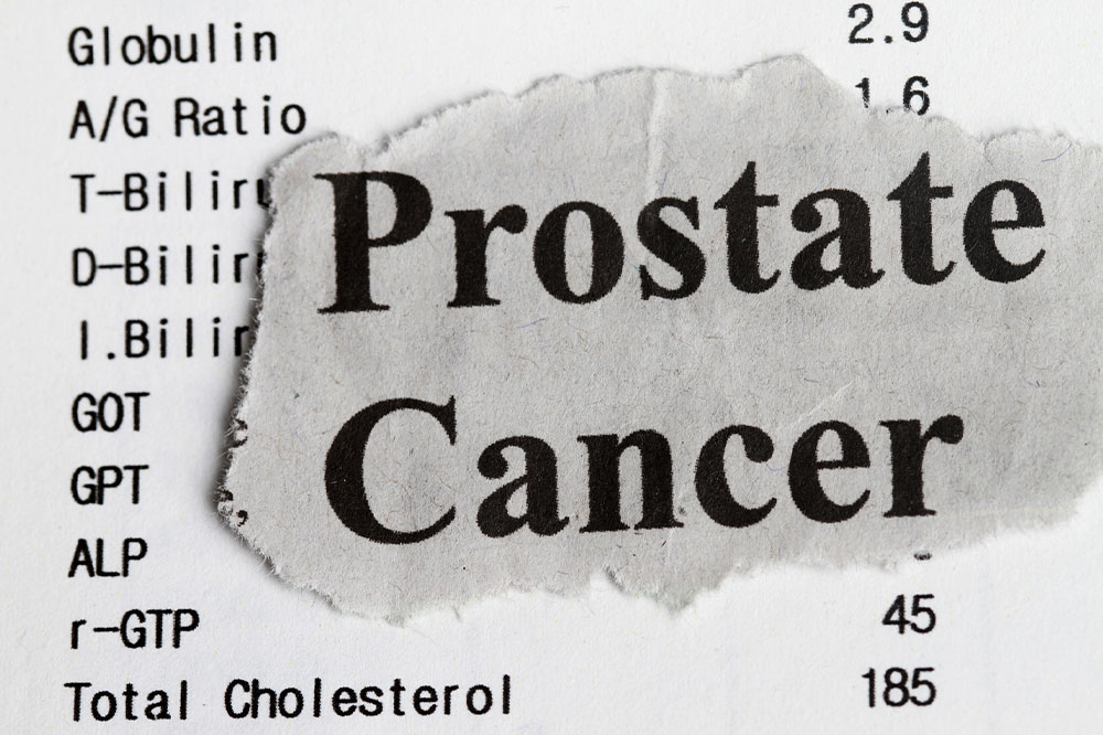 Stages, and Ways to Manage Prostate Cancer