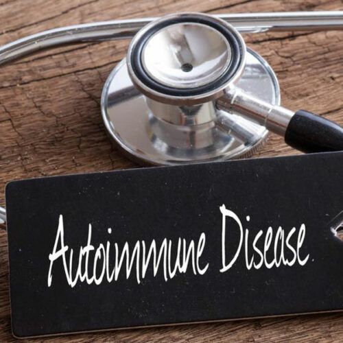 4 tips for timely diagnosis of autoimmune disease