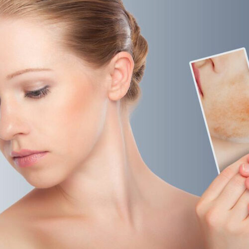 6 things you should not do if you have skin rash