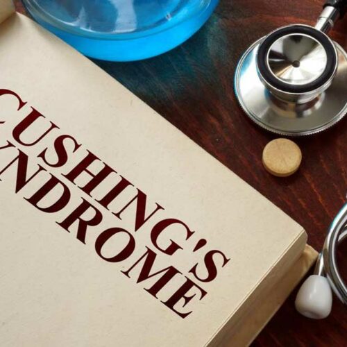 Common Signs and Symptoms of Cushing Syndrome