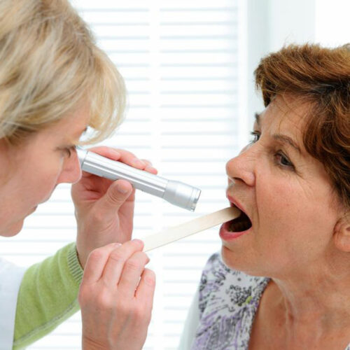 Common symptoms of tongue cancer you should know