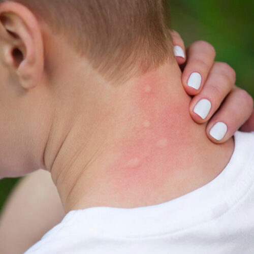 Causes and diagnosis of itchy skin