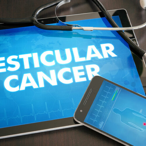 A Brief Overview of Testicular Cancer