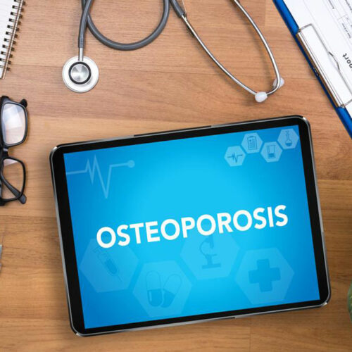 A brief overview of osteoporosis