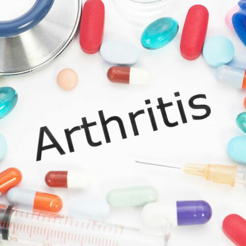 Arthritis &#8211; Classification and treatment