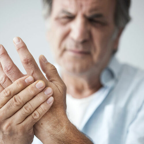 Arthritis &#8211; Types, signs and risk factors