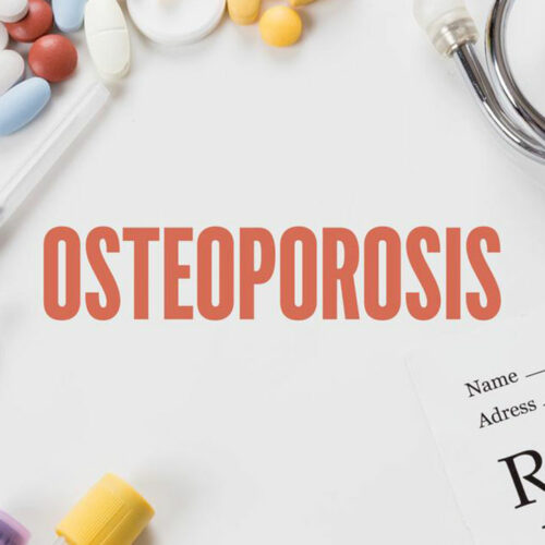 Bone density testing &#8211; An important diagnostic tool for osteoporosis