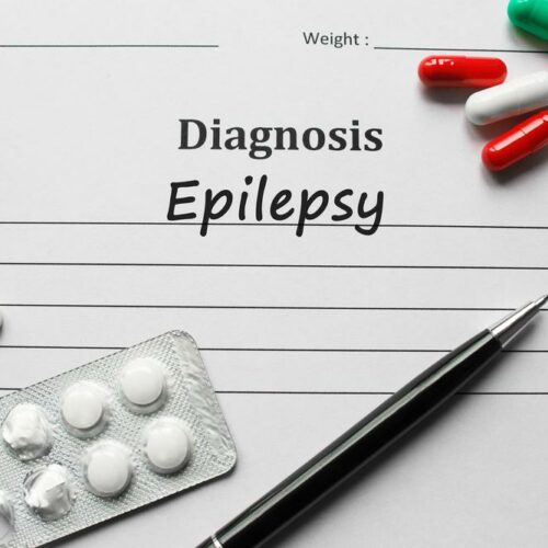 Epilepsy: Causes and Risk Factors