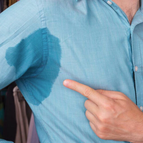 How to tackle excessive sweating