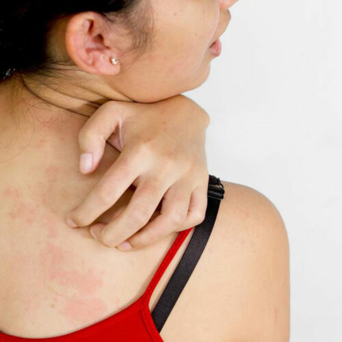 Here are a few common causes of itchy skin