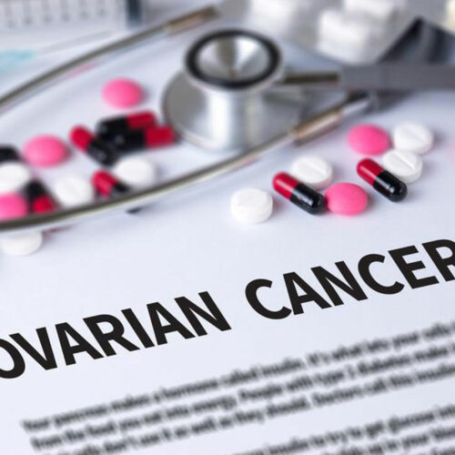 Here’s What You Need to Know about Ovarian Cancer