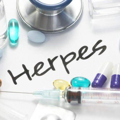 Herpes: Things one should be aware of