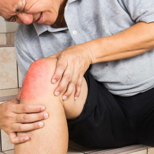 7 Effective Home Remedies for Quick Relief from Joint Pain