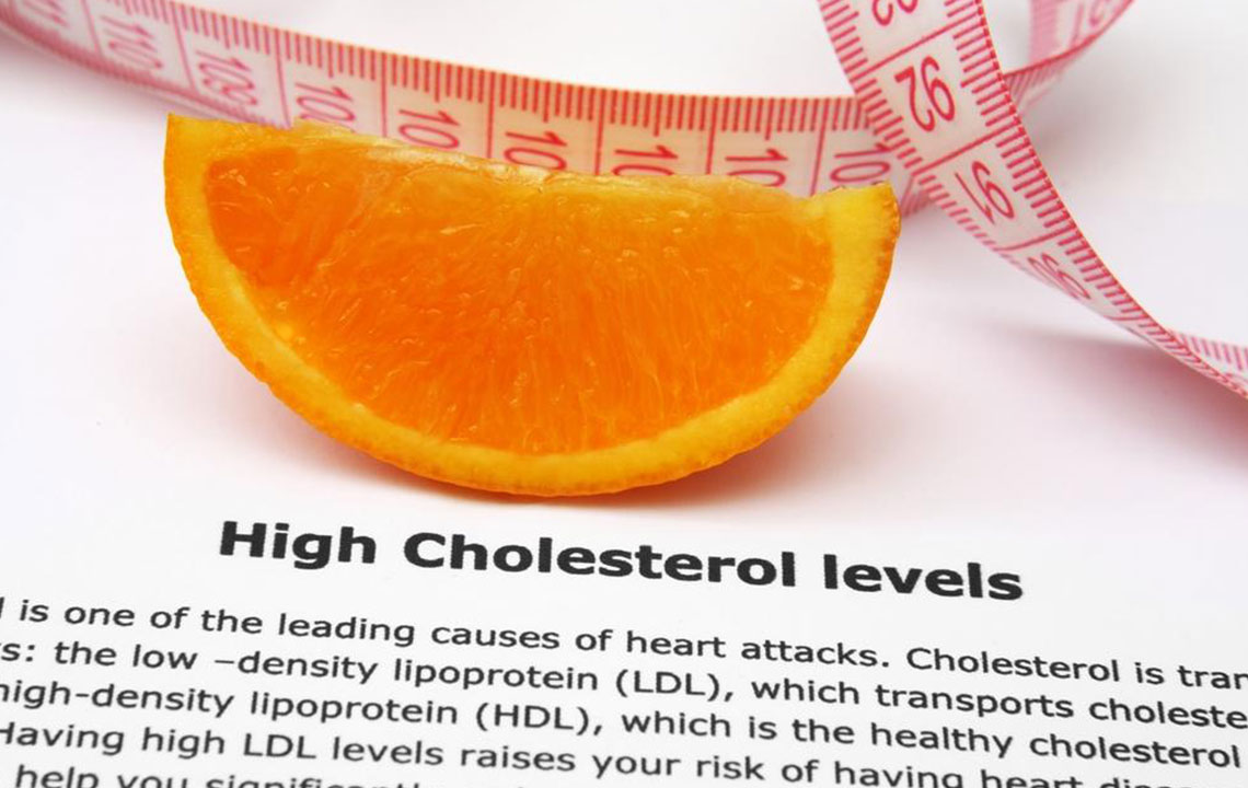 6 Self-Management Tips for High Cholesterol Treatment