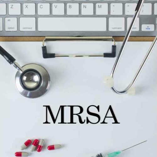 Causes, Symptoms and Treatment for MRSA