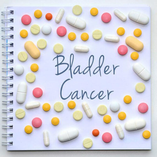 Do You Have Any of These Bladder Cancer Symptoms?