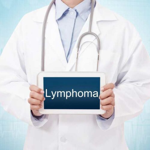 Different Types of Lymphoma You Should Know about