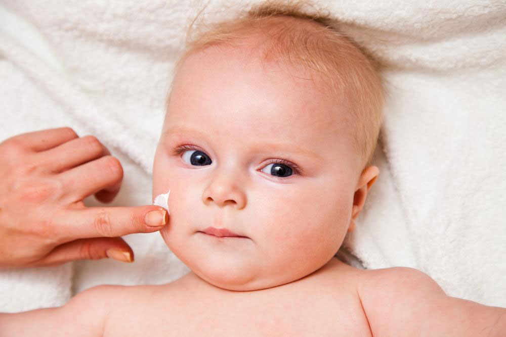 Know More About The Symptoms Causes And Treatment Options For Eczema In Infants