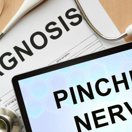 Know about the Pinched Nerve Treatment, Causes, and Symptoms