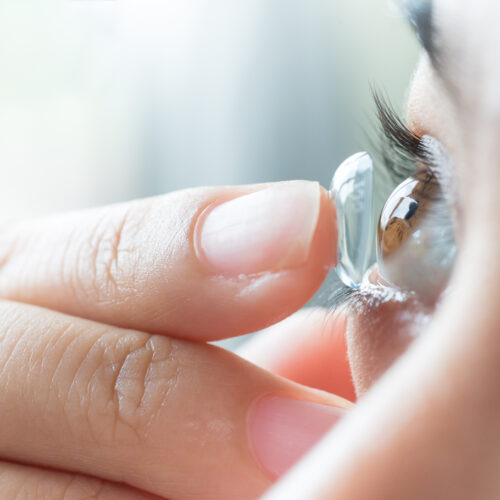 Here Is How You Can Avoid A Dry Eye Condition Caused By Contact Lenses