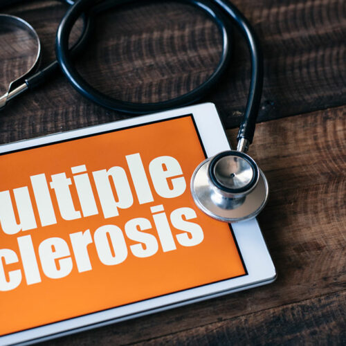 Here are some important things to keep in mind about multiple sclerosis