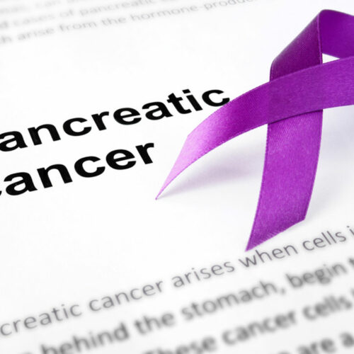 Symptoms of pancreatic cancer