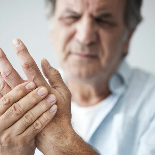 What you did not know about arthritis