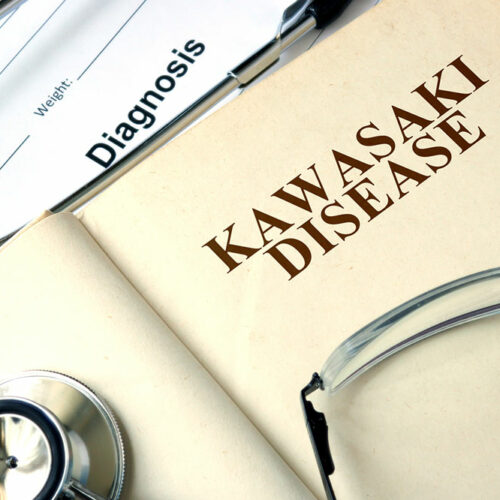 The effect of diet on Kawasaki disease