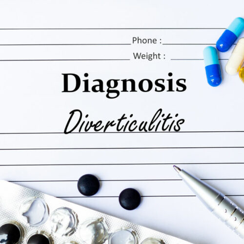 Things to Know about Diverticulitis