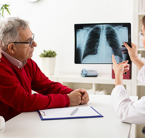 Types and Stages of Lung Cancer