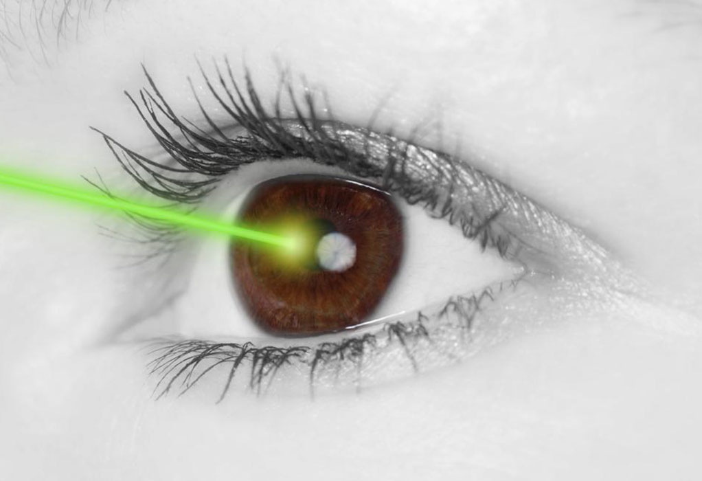 Lasik Eye Surgery Cost And Procedure