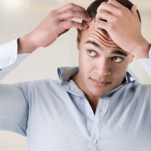 Hair Transplant &#8211; Procedure, Cost, and Factors to Consider