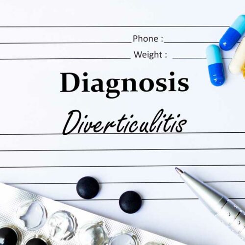 7 Probiotic-Rich Foods to Try When Dealing with Diverticulitis